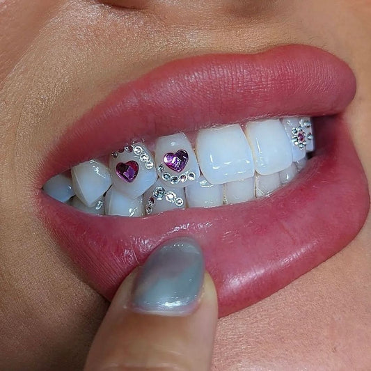 Comment développer sa clientèle en pose de strass dentaire ?